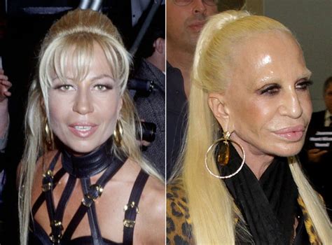 donatella versace avant apres|Versace wikipedia.